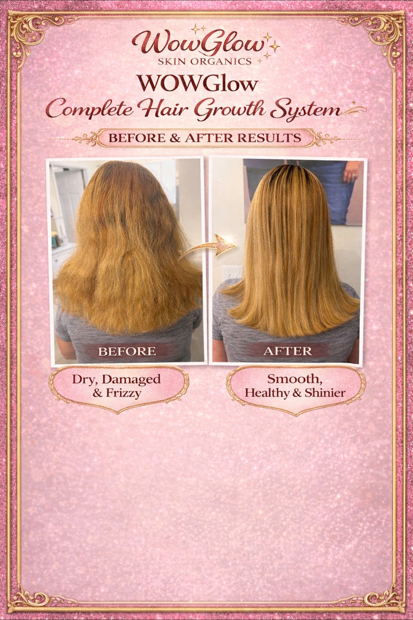 💖 WowGlow Complete Hair Growth System