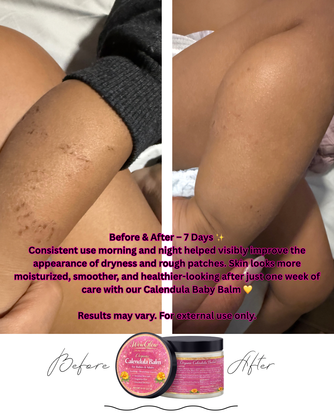 Calendula balm for baby and adult no Essential oil (very sensitive skin)